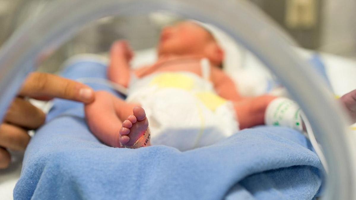 Study by doctors find new tool to detect health risks in premature newborns